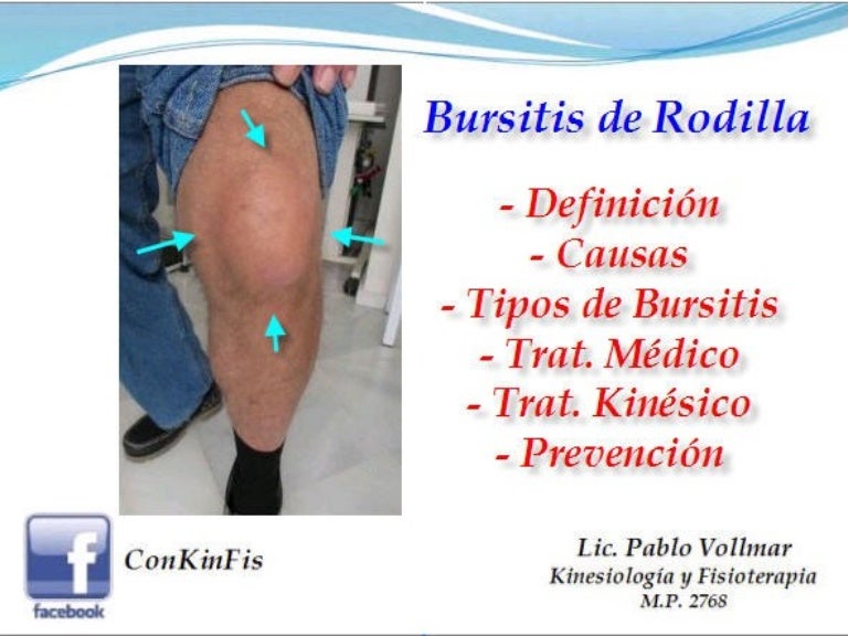 De rodilla fisioterapia bursitis